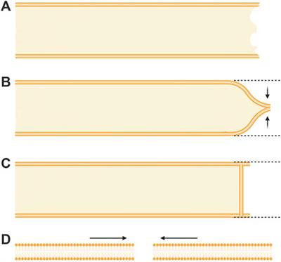 Repair of traumatic lesions to the plasmalemma of neurons and other cells: Commonalities, conflicts, and controversies